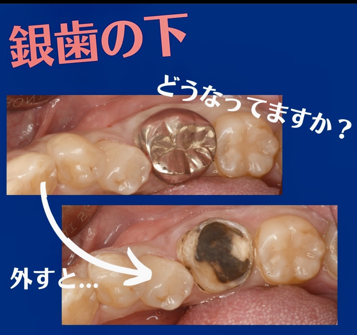 佐賀市の歯医者、池田歯科こども歯科の「中高年の歯科治療」専門サイト