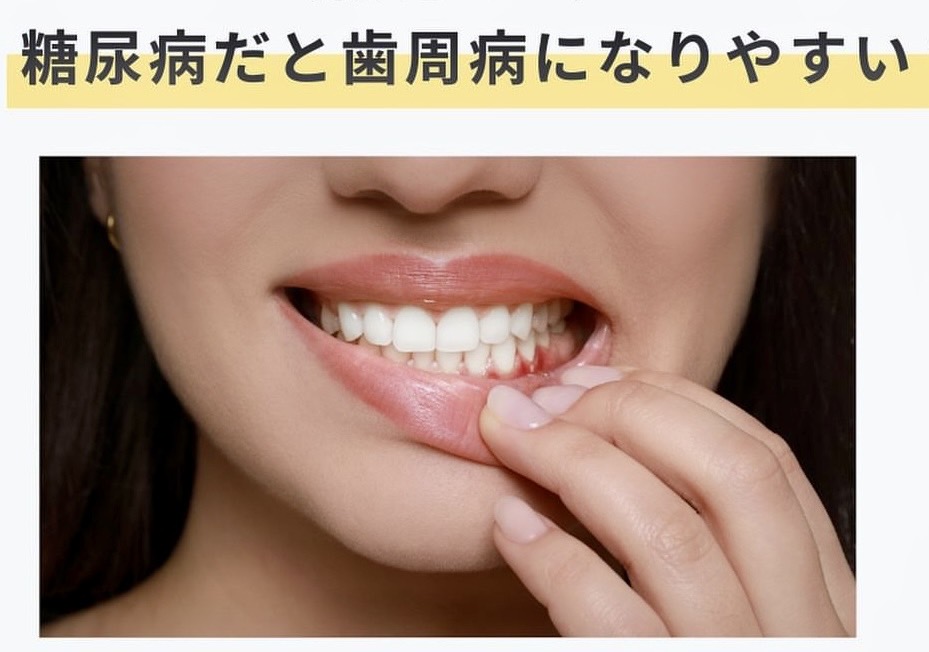 佐賀市の歯医者、池田歯科こども歯科の糖尿病歯周病専門サイト