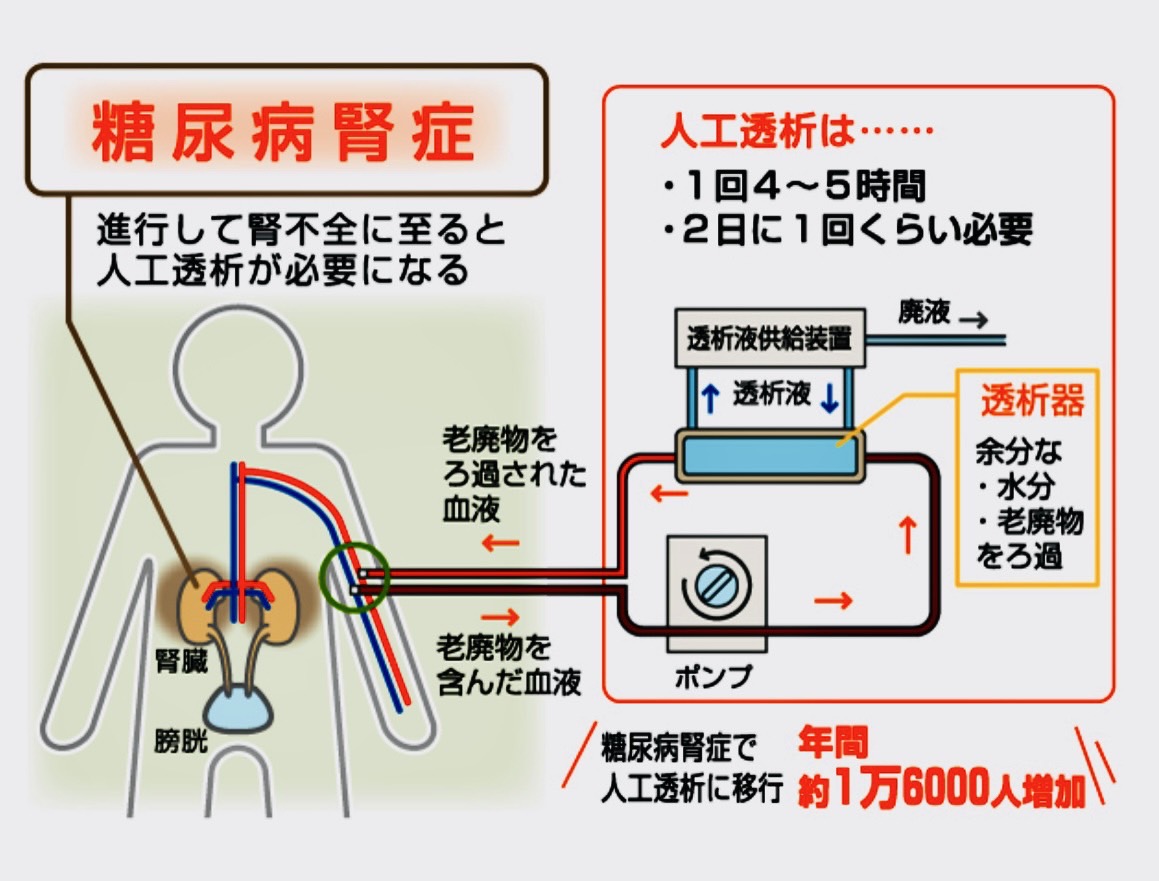 佐賀市の歯医者、池田歯科こども歯科の糖尿病歯周病専門サイト