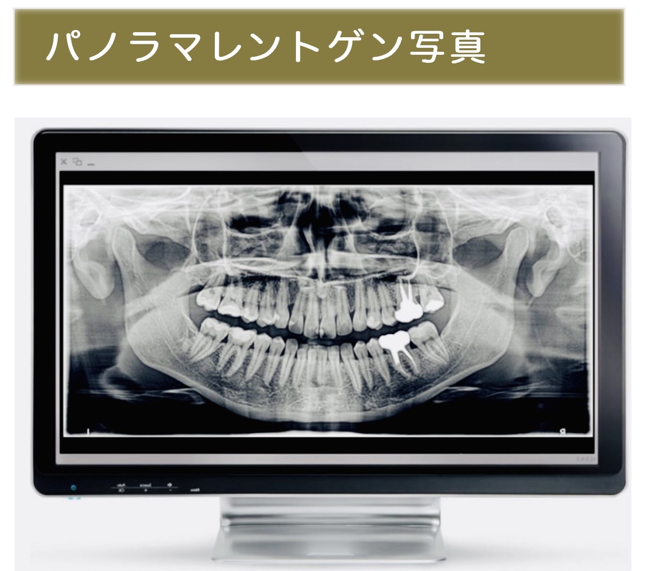 佐賀市の歯医者、池田歯科こども歯科の糖尿病歯周病専門サイト