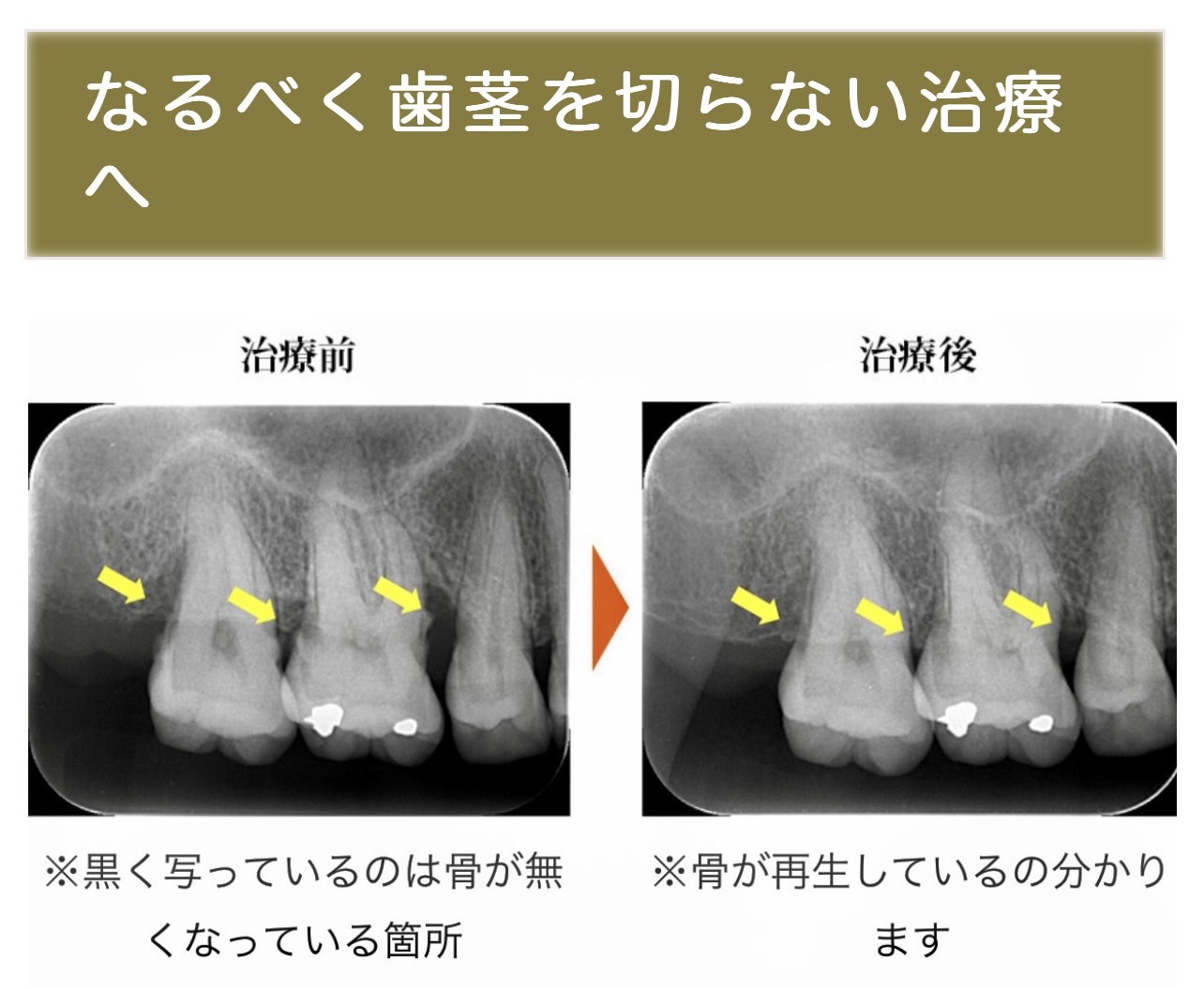 佐賀市の歯医者、池田歯科こども歯科の糖尿病歯周病専門サイト