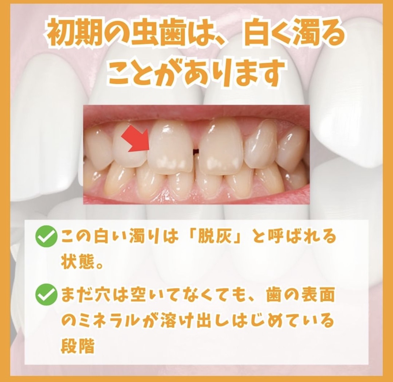佐賀市の歯医者、池田歯科こども歯科の糖尿病歯周病専門サイト