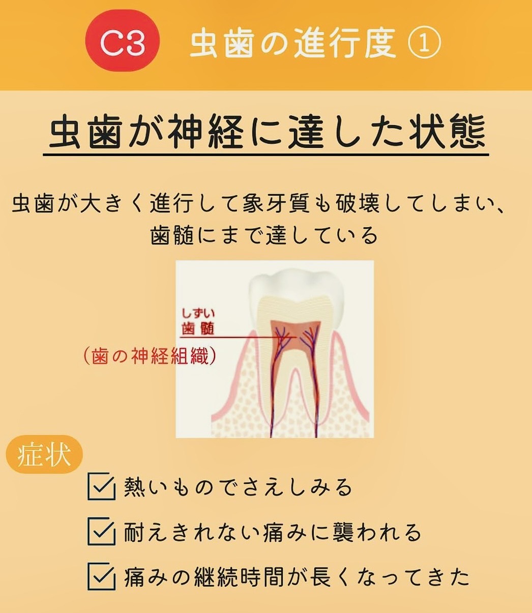 佐賀市の歯医者、池田歯科こども歯科のむし歯治療専門サイト