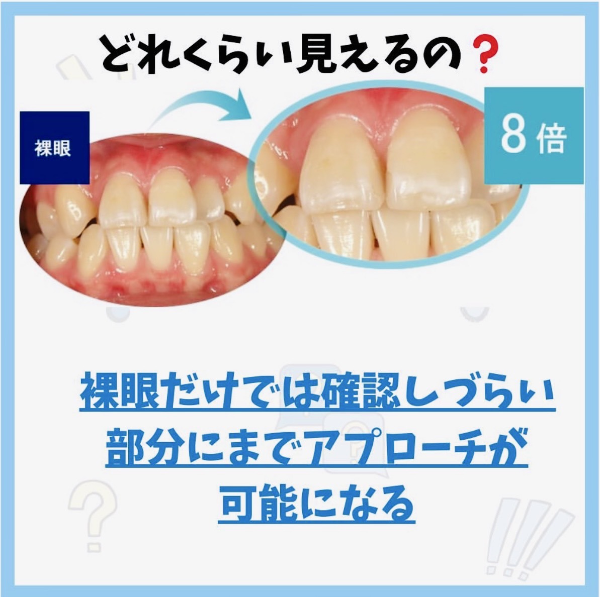 佐賀市の歯医者、池田歯科こども歯科の糖尿病歯周病専門サイト