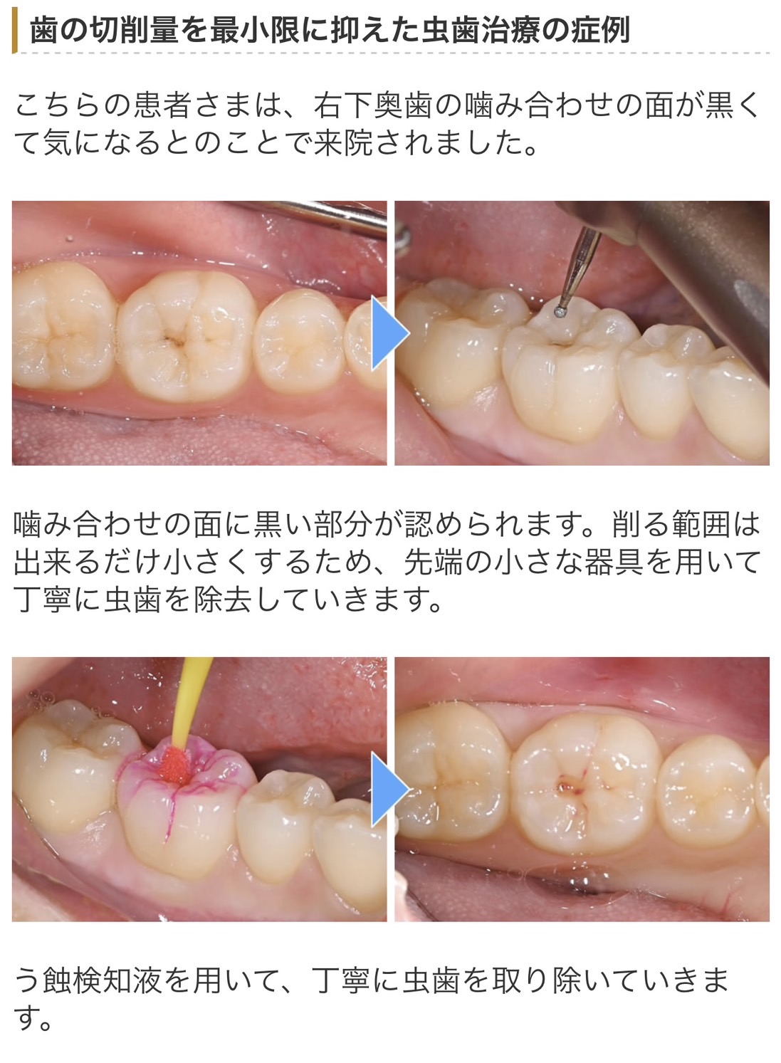 佐賀市の歯医者、池田歯科こども歯科の糖尿病歯周病専門サイト