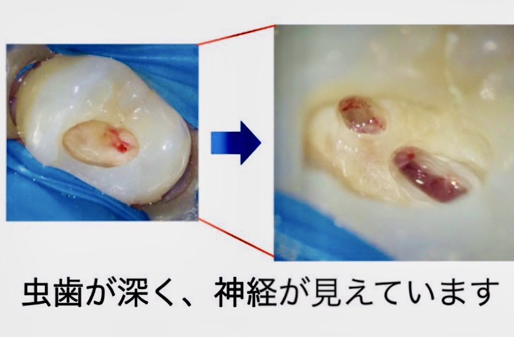佐賀市の歯医者、池田歯科こども歯科の糖尿病歯周病専門サイト