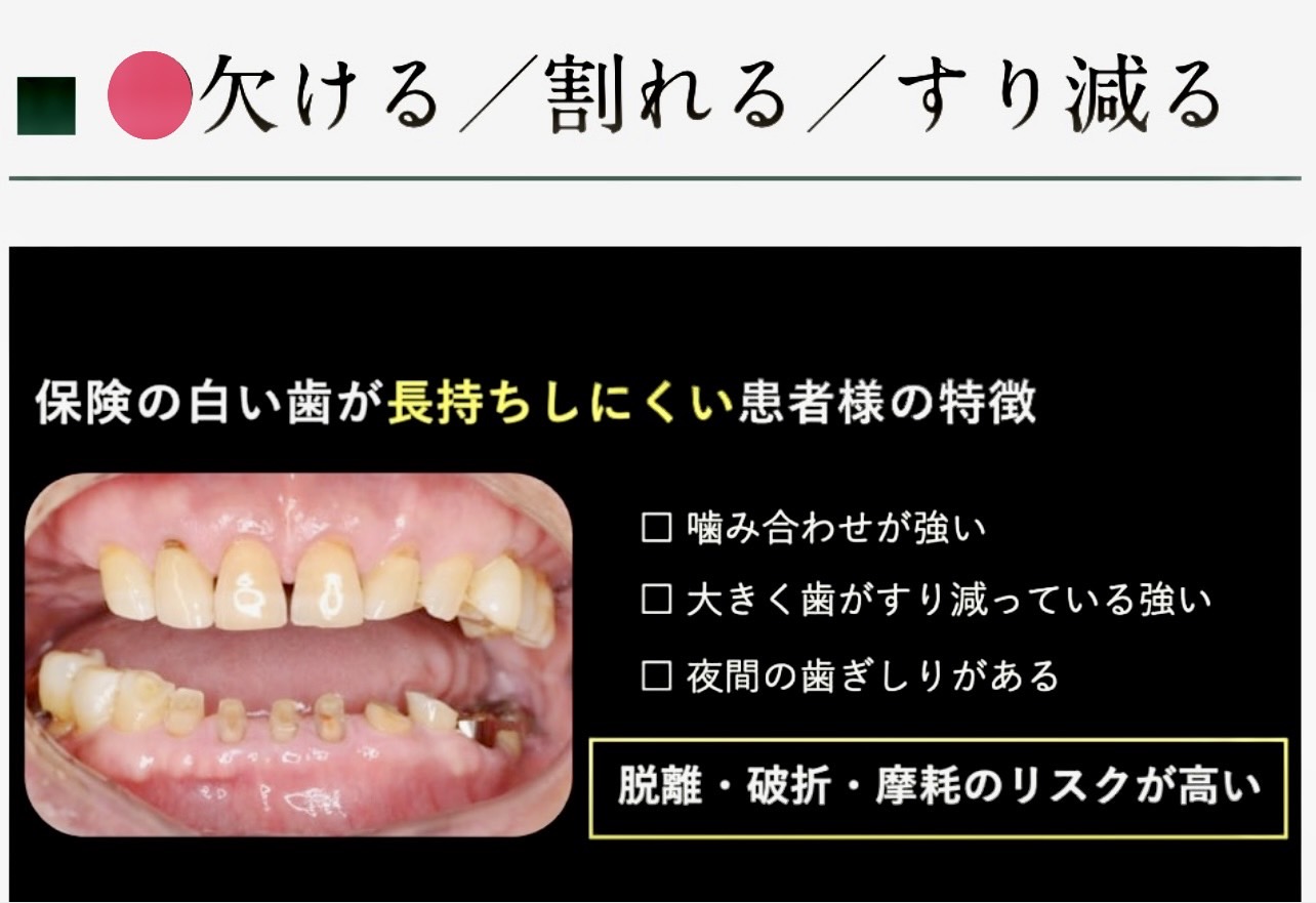 佐賀市の歯医者、池田歯科こども歯科のむし歯治療専門サイト