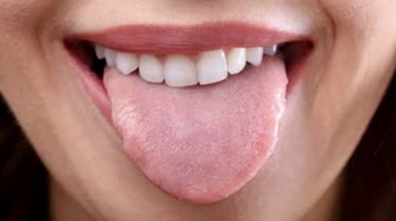 佐賀市の歯医者、池田歯科こども歯科の舌痛症治療
