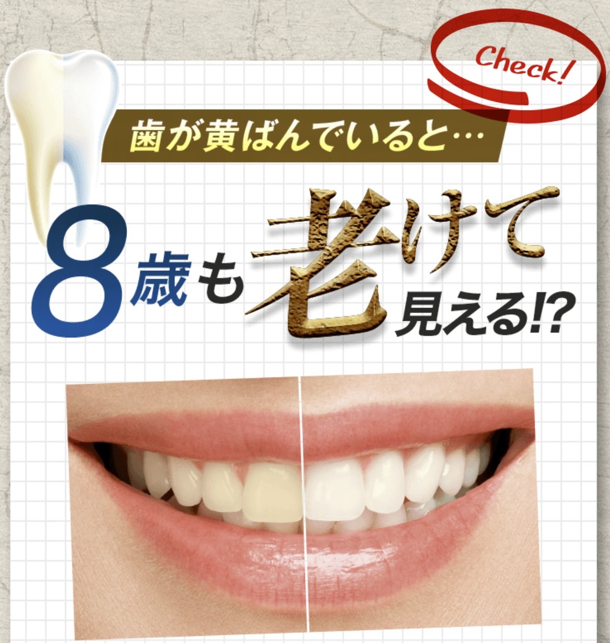 佐賀市の歯医者、池田歯科こども歯科でホワイトニング