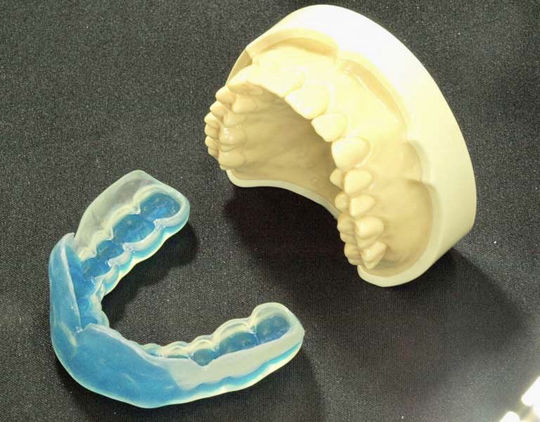 佐賀市の歯医者、池田歯科こども歯科でスポーツ用マウスピース作製