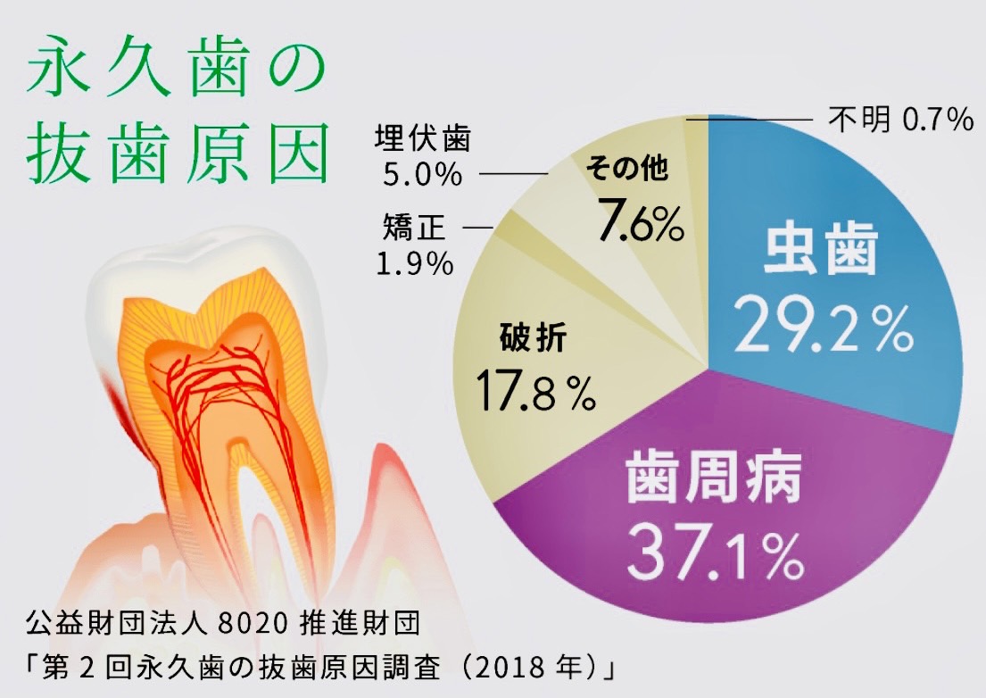 佐賀市の歯医者、池田歯科こども歯科で定期検診