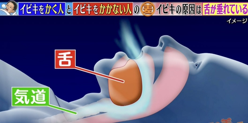 佐賀市の歯医者、池田歯科こども歯科の睡眠時無呼吸症候群・いびき専門外来