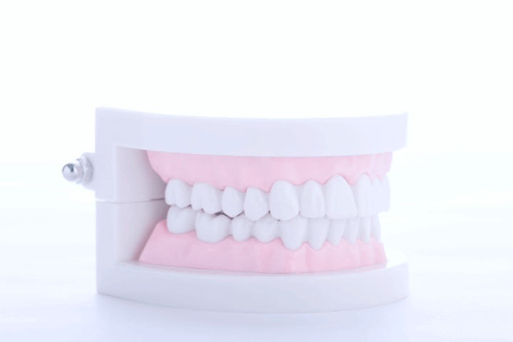 佐賀市の歯医者、池田歯科こども歯科で歯ぎしりの治療