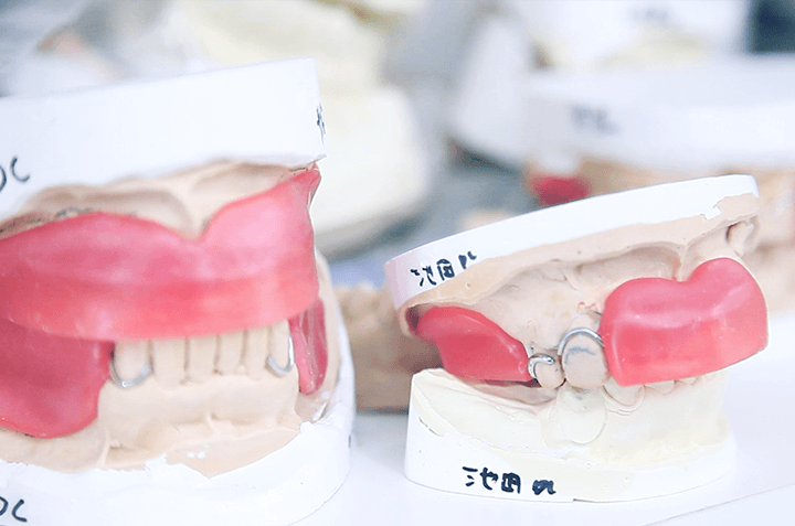 佐賀市の歯医者、池田歯科こども歯科で入れ歯治療
