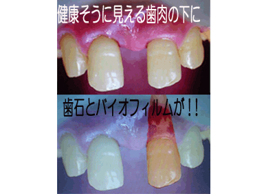 佐賀市の歯医者、池田歯科こども歯科の口臭専門外来
