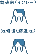 佐賀市の歯医者、池田歯科こども歯科の料金表