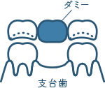 佐賀市の歯医者、池田歯科こども歯科の料金表